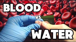 Blood Cells vs Distilled Water Under Microscope