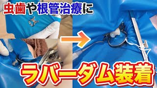 虫歯や根管治療に使用されるラバーダムの装着手順！細菌予防や防湿に【名古屋茶屋歯科・矯正歯科】