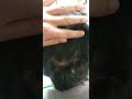 Hair Transformation Journey With Dr Sajid Mughal