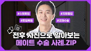 다양한 사례로 알아보는 성형스타일 | 콤플렉스 해결할 쉬운 방법 | FULL 01 | 메이트성형외과