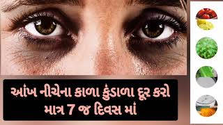 આંખ નીચે કાળા કુંડાળા દૂર કરવાના ઉપાય🧐 aankh niche kala kundala |Remove dark circles|Aayurvedik Tips