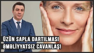 Üzün Sapla Dartılması - Əməliyyatsız Cavanlaş! Kosmetik Dermatoloq Dr.Mehdi Tel: +994 50 519 42 19