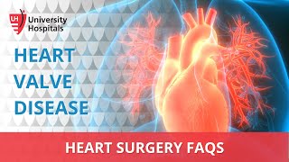 Heart Surgery FAQs - Heart Valve Disease