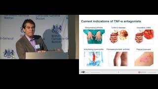 Julio Delgado: Assessment of TNF alpha antagonists and Anti Drug Antibodies