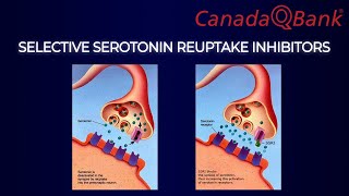 Selective Serotonin Reuptake Inhibitors (SSRIs)