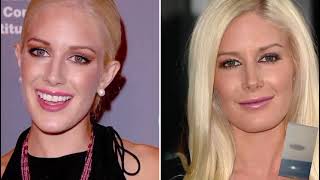 10 Celebrity Plastic Surgery Disasters