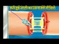 कटी हुई उंगली का सर्जरी 3d वीडियो kati hui umgali ki surgery ungali surgery cut surgery