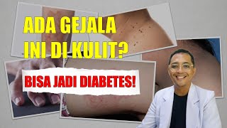 12 Masalah Kulit Diabetes & Gejala Diabetes pada Kulit! | Dr Ruly