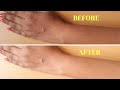 How To Remove Sun Tan From Your Body Instantly | Home remedy How To Remove Sun Tan From Your Body Instantly | Home remedy