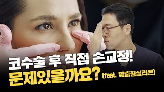 268화. 코수술후 내가 직접 손교정! 문제 있을까?