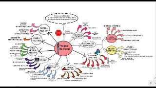 Vaginal Discharge - OSCE