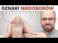 11 oznak niedoborów witamin w Twoim ciele