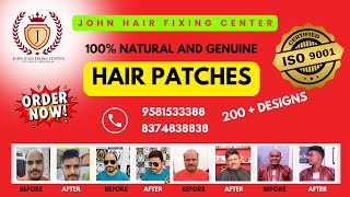 Top Hair Patches Designs I Certified Hair Patches I Natural and Best Quality Hair Patches