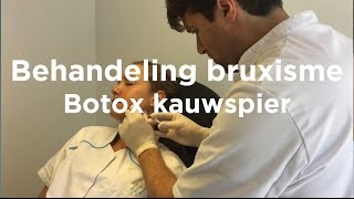 Behandeling bruxisme kauwspier kaak met Botox