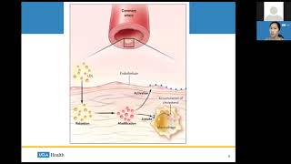 Beyond Statins: Optimizing Cholesterol Through Nutrition