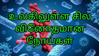 World medical mystery tamil உலகில் சில வினோதமான நோய்கள்