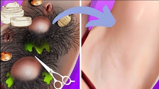 ASMR Removal dog ticks from the armpit of handsome Girl | Deep Cleaning Animation