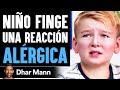 Niño Finge Una Reacción ALÉRGICA | Dhar Mann