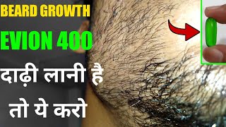 BEARD GROWTH EVION 400 | दाढ़ी लानी है तो ये करो | Grow your fast beard | We know hair