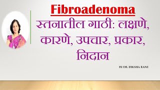 Fibroadenoma | स्तनातील गाठी: लक्षणे, कारणे, उपचार, प्रकार, निदान