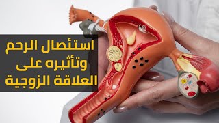 عملية استئصال الرحم وتأثيرها على العلاقة الزوجية ؟