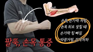 단, 5분! 팔뚝, 손목이 편해져 심장이 두근두근💓 될 거에요❗️❗️손목, 손가락 저림, 손목 위로 젖힐 때, 손가락 힘빠짐, 감각저하 (Radial tunnel Syndrome)