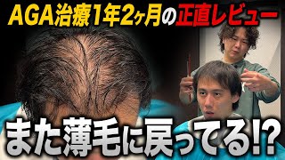 【30歳薄毛】治療薬を1年2ヶ月飲み続けたリアルな状態がヤバい...！