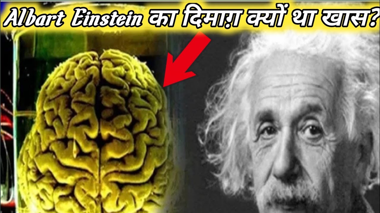 Albert Einsteins Brain Compared Average Brain