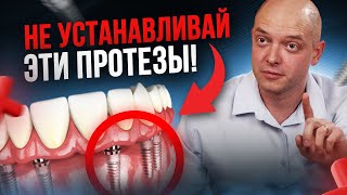 НЕ УСТАНАВЛИВАЙ эти ЗУБНЫЕ ПРОТЕЗЫ! Как выбрать лучшие съемные протезы?