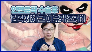 [닥터봉TV_CBK성형외과_최봉균]안면윤곽수술후 감각저하 절개를 조커처럼 잘라서 신경이?!![CBK整形外科_チェ·ボンギュン] 顔面輪郭手術後、切開をジョーカーのように切って神経が？！