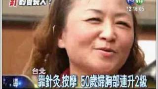 靠針灸按摩 50歲婦胸部連升2級