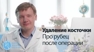 КОСТОЧКИ НА НОГАХ: про послеоперационный рубец | Доктор Алексей Олейник