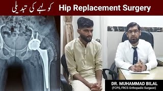 Hip Replacement Surgery Young Patient in Lahore Pakistan | MIS Hip Replacement