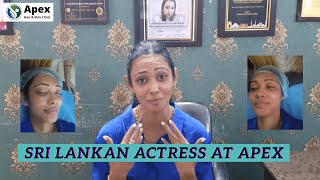 Sri Lankan Actress (Yureni Noshika) Talks about Apex Hair transplant \u0026 Skin Clinic, Noida