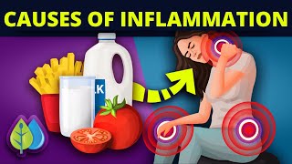 Top 11 causes of inflammation |  Top causes of chronic inflammation