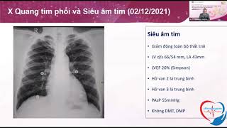 Gánh nặng bệnh lý bệnh mạch vành nhân một case lâm sàng