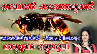 കടന്നൽ കുത്തേറ്റാൽ ഞൊടിയിടയിൽ  നീരും വീക്കവും മാറ്റുന്ന ഒറ്റമൂലി! INSECT BYTE NATURAL REMEDY