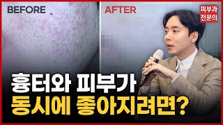 울트라펄스앙코르 ｜ 강의 후기 ｜흉터 치료 원탑｜받으면 절대 안 되는 경우는?