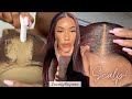 This is SCALP! | Hiding Grids and Knots NO Bleach on Frontal | MyFirstWig x LovelyBryana