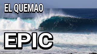 29-11-2024 El Quemao - EPIC