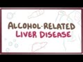 Alcohol-related liver disease - causes, symptoms & pathology Alcohol-related liver disease - causes, symptoms & pathology