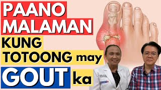 Paano Malaman Kung Totoong May Gout Ka. - By Dra Vinny Mina (Rheumatologist) and Doc Willie Ong