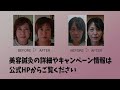 【美容鍼】美容鍼灸サロンamanの美容鍼！施術の流れをご紹介します。