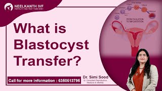 IVF Blastocyst Transfer  | How to IVF Blastocyst Transfer
