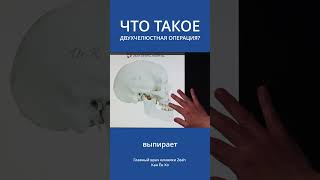 Что такое двухчелюстная ортогнатическая операция? #ортогнатическаяоперациявкорее #ортогнатическая