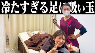 【吸い玉 足】冷え性とむくみに悩む女性の足に吸い玉をした結果...