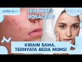 Perbedaan Jerawat dan Rosacea || Jangan Sampai Salah Penanganannya!