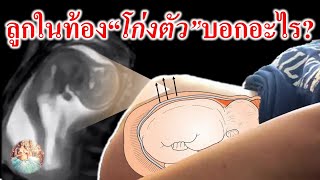 พัฒนาการทารกในครรภ์ : ลูกในท้องโก่งตัว บอกอะไร? | ลูกน้อยในครรภ์ | คนท้อง Everything