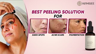 Facial वाला Glow with Chemical Peel Treatment at Home |for acne scars \u0026 pigmentation | live results