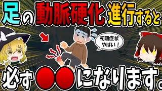 【ガンより死亡率が高い】足の動脈硬化の要注意な危険サイン！進行すると必ずこうなります！